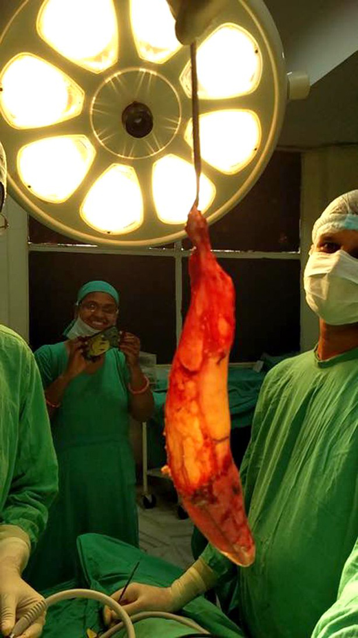 GALLBLADDER